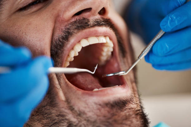 TMJ/TMD Treatment in Lindenwold, NJ
